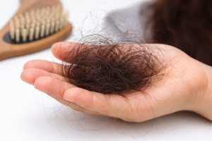 rụng tóc sau sinh có thực sự đáng lo không?