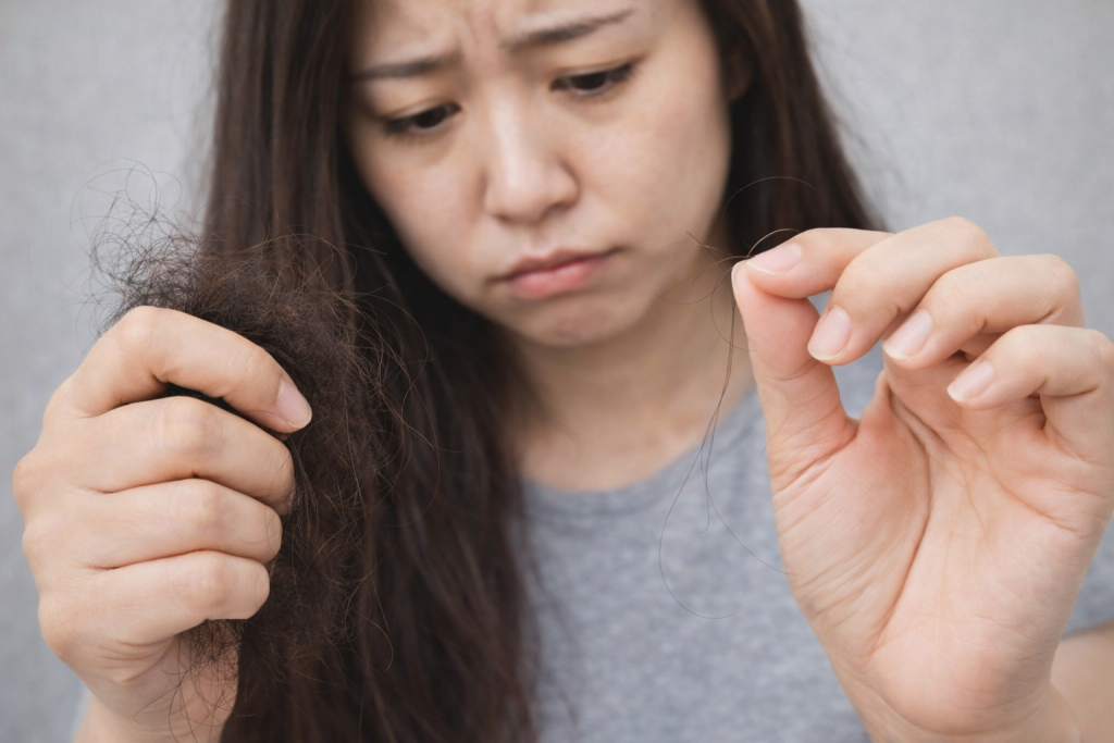 rụng tóc sau sinh khi nào là bất thường?